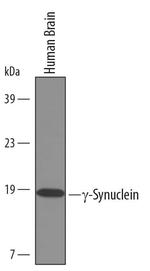 gamma Synuclein Polyclonal Antibody