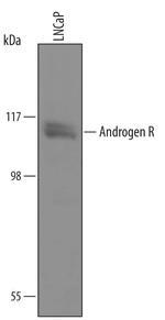 Androgen Receptor Polyclonal Antibody
