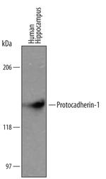 PCDH1 Polyclonal Antibody