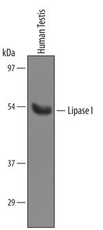 LIPI Polyclonal Antibody