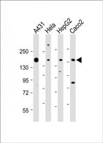 PTK7 Antibody in Western Blot (WB)