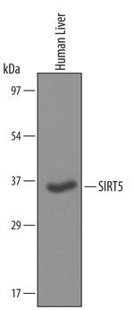 SIRT5 Polyclonal Antibody