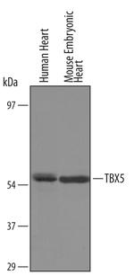 TBX5 Polyclonal Antibody