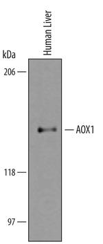 AOX1 Polyclonal Antibody