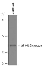 ORM1 Polyclonal Antibody