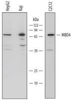 MBD4 Polyclonal Antibody