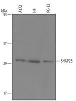 SNAP25 Polyclonal Antibody