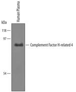 CFHR4 Antibody in Western Blot (WB)