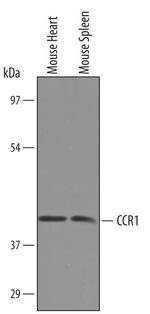 CCR1 Polyclonal Antibody