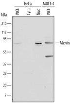 Menin Polyclonal Antibody