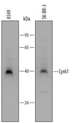 CYR61 Polyclonal Antibody