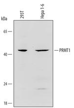 PRMT1 Polyclonal Antibody