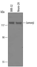 JARID2 Polyclonal Antibody