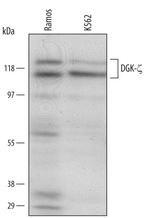 DGKZ Polyclonal Antibody