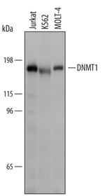 DNMT1 Polyclonal Antibody