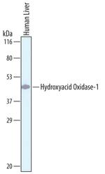 HAO1 Polyclonal Antibody