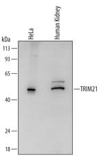 TRIM21 Polyclonal Antibody