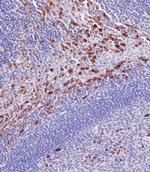 IRAK-M Polyclonal Antibody