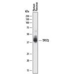TPST2 Polyclonal Antibody