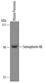 SEMA4B Antibody in Western Blot (WB)