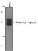 Prostate Specific Acid Phosphatase Polyclonal Antibody
