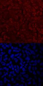 TWIST2 Polyclonal Antibody