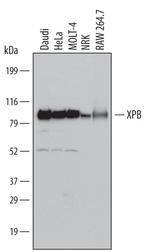 XPB Polyclonal Antibody