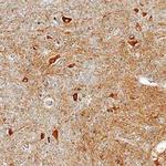 QPCT Polyclonal Antibody