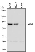 Zap-70 Antibody in Western Blot (WB)