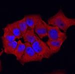 GSTP1 Polyclonal Antibody