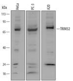 TRIM32 Polyclonal Antibody