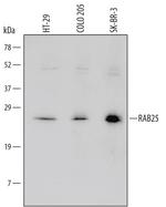 RAB25 Polyclonal Antibody