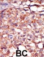 RIPK4 Polyclonal Antibody