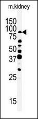 RIPK4 Antibody in Western Blot (WB)