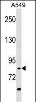 RIPK4 Antibody in Western Blot (WB)