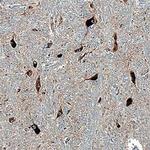 STX12 Polyclonal Antibody