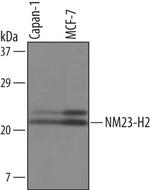 NME2 Polyclonal Antibody