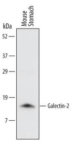 Galectin 2 Polyclonal Antibody