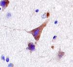 LRRK2 Polyclonal Antibody