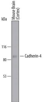 CDH4 Polyclonal Antibody
