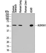 ALDH3A1 Polyclonal Antibody