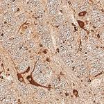 NENF Polyclonal Antibody