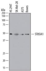 ST8SIA1 Polyclonal Antibody