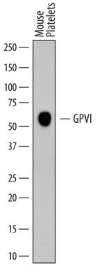 GP6 Polyclonal Antibody