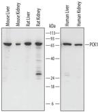 PCK1 Polyclonal Antibody