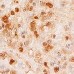 SMARCA5 Polyclonal Antibody