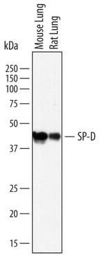 SFTPD Polyclonal Antibody