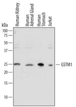 GSTM1 Polyclonal Antibody