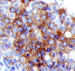 BRCA1 Antibody in Immunohistochemistry (Paraffin) (IHC (P))