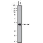 AKR1C4 Polyclonal Antibody